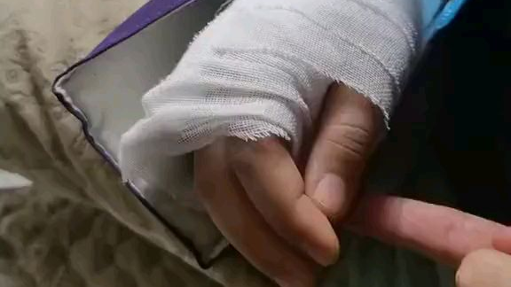 医学奇迹